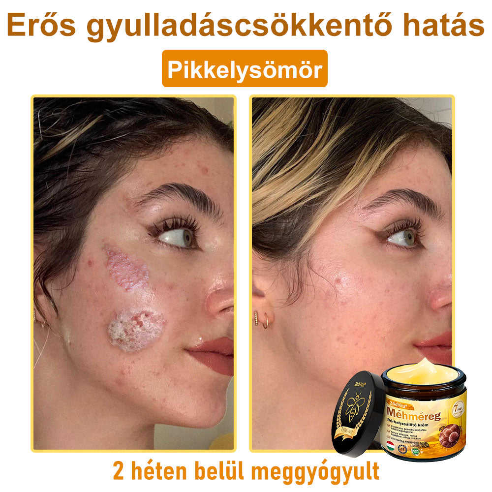 🐝👨⚕ ZödVita® Méhméreg Bőr Helyreállító Krém (👨⚕CE jóváhagyott)👍✅