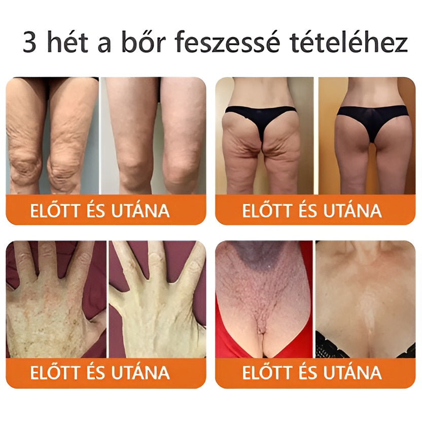🐝👨⚕ ZödVita® Méhméreg Bőr Helyreállító Krém (👨⚕CE jóváhagyott)👍✅