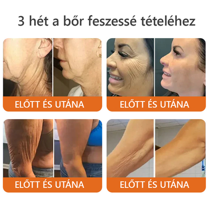 🐝👨⚕ ZödVita® Méhméreg Bőr Helyreállító Krém (👨⚕CE jóváhagyott)👍✅