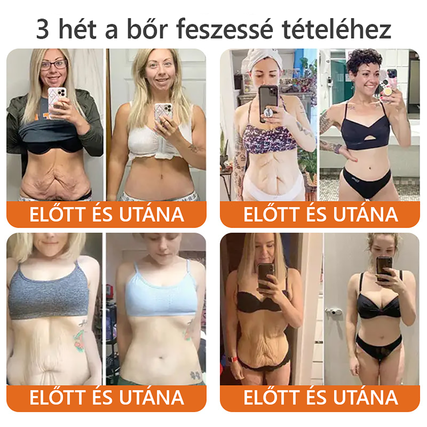 🐝👨⚕ ZödVita® Méhméreg Bőr Helyreállító Krém (👨⚕CE jóváhagyott)👍✅