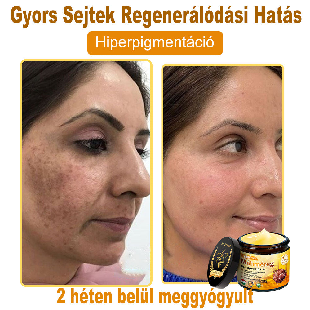 🐝👨⚕ ZödVita® Méhméreg Bőr Helyreállító Krém (👨⚕CE jóváhagyott)👍✅