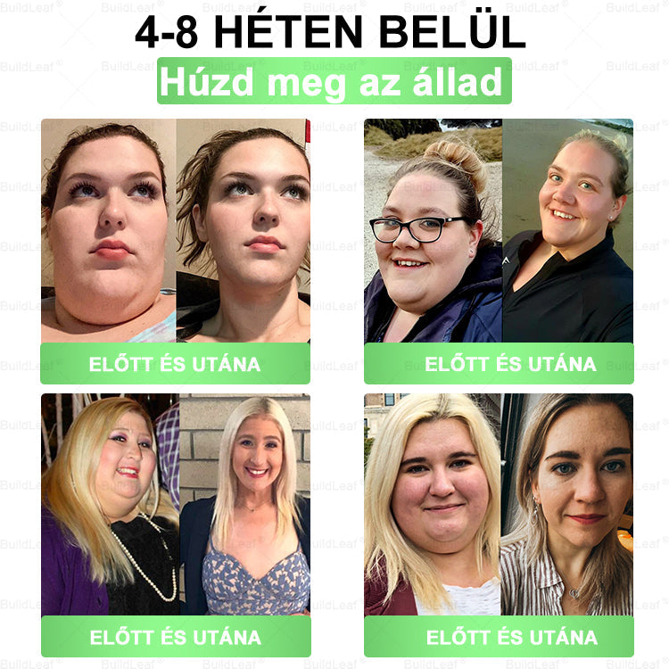 đBuildLeafÂź GLP-1 8-az-1 Slim & EgĂ©szsĂ©ges Oldat (Napi 1 adag · EredmĂ©ny 7 nap alatt),SegĂti a fogyĂĄst, vĂ©di a szĂvet, szabĂĄlyozza a cukorszintet, javĂtja az emĂ©sztĂ©st Ă©s az ĂzĂŒleteket â miközben feszesĂti a bĆrt Ă©s növeli az energiĂĄt.