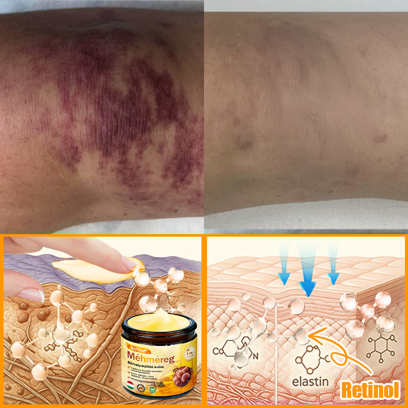 🐝👨⚕ ZödVita® Méhméreg Bőr Helyreállító Krém (👨⚕CE jóváhagyott)👍✅