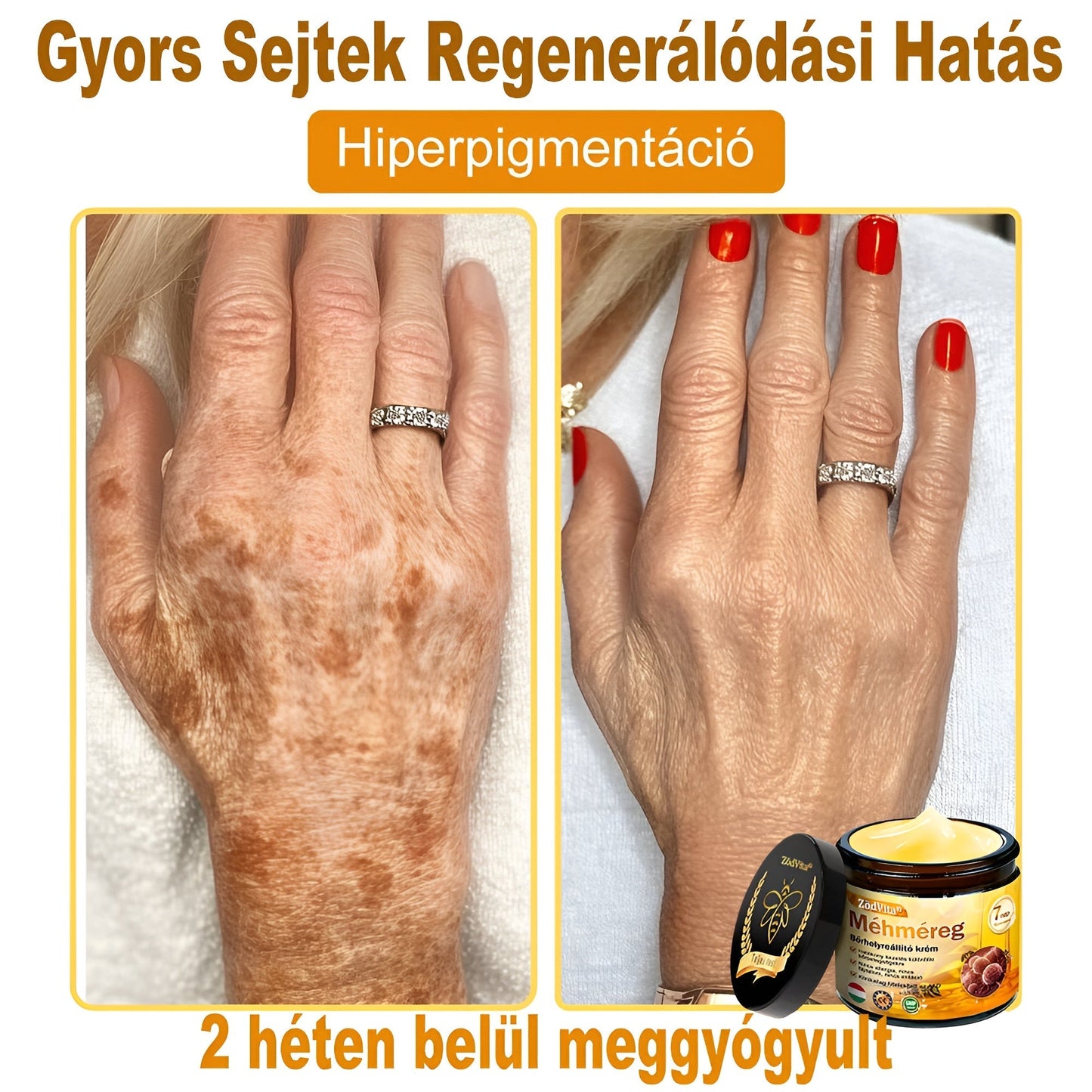 🐝👨⚕ ZödVita® Méhméreg Bőr Helyreállító Krém (👨⚕CE jóváhagyott)👍✅