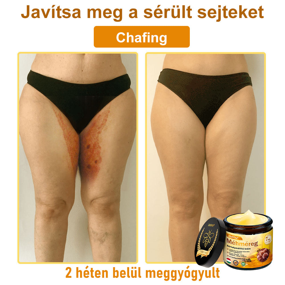🐝👨⚕ ZödVita® Méhméreg Bőr Helyreállító Krém (👨⚕CE jóváhagyott)👍✅
