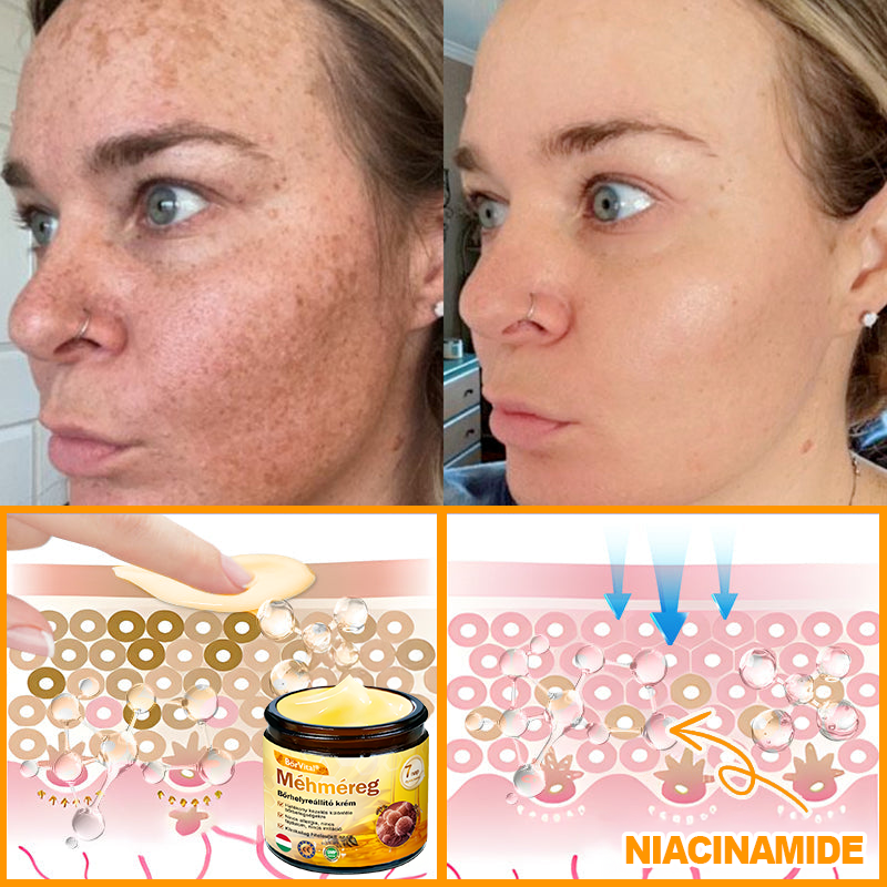 🐝👨⚕ ZödVita® Méhméreg Bőr Helyreállító Krém (👨⚕CE jóváhagyott)👍✅