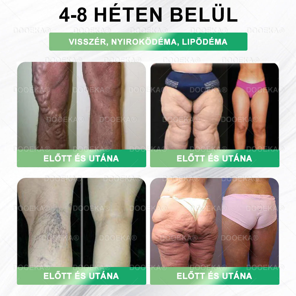 🧑⚕️DOOEKA® GLP-1 8 az 1-ben Fit & Vital Szájon át szedhető oldat – Napi egyszer, 7 nap alatt látható változás / Elhízás, szív- és érrendszeri egészség, cukorbetegség, alvási apnoe, bélrendszer egészsége, ízületi problémák és még sok más esetén