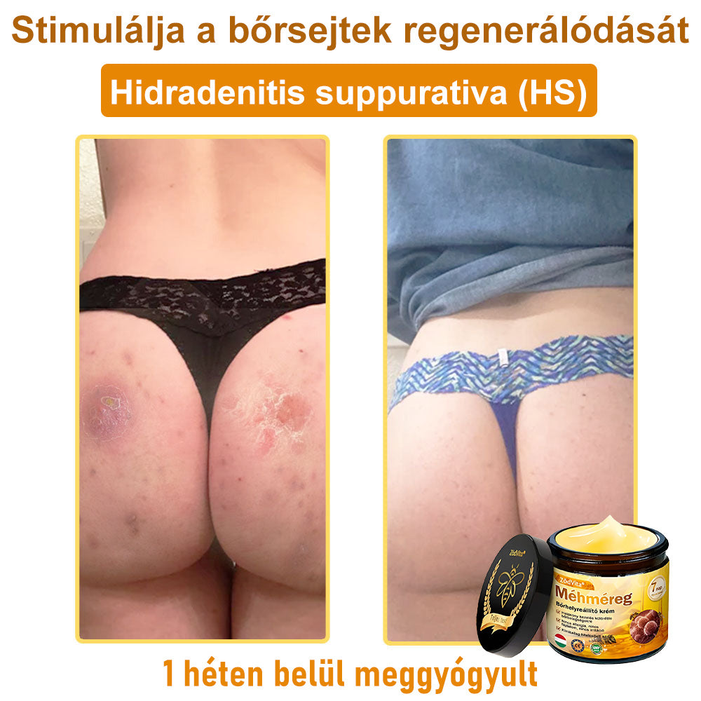 🐝👨⚕ ZödVita® Méhméreg Bőr Helyreállító Krém (👨⚕CE jóváhagyott)👍✅