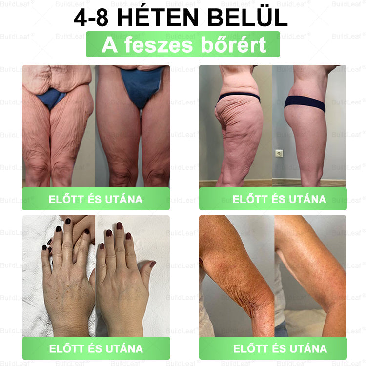 đBuildLeafÂź GLP-1 8-az-1 Slim & EgĂ©szsĂ©ges Oldat (Napi 1 adag · EredmĂ©ny 7 nap alatt),SegĂti a fogyĂĄst, vĂ©di a szĂvet, szabĂĄlyozza a cukorszintet, javĂtja az emĂ©sztĂ©st Ă©s az ĂzĂŒleteket â miközben feszesĂti a bĆrt Ă©s növeli az energiĂĄt.
