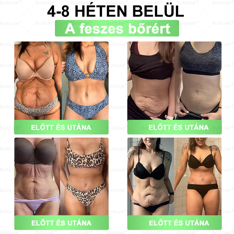 đBuildLeafÂź GLP-1 8-az-1 Slim & EgĂ©szsĂ©ges Oldat (Napi 1 adag · EredmĂ©ny 7 nap alatt),SegĂti a fogyĂĄst, vĂ©di a szĂvet, szabĂĄlyozza a cukorszintet, javĂtja az emĂ©sztĂ©st Ă©s az ĂzĂŒleteket â miközben feszesĂti a bĆrt Ă©s növeli az energiĂĄt.