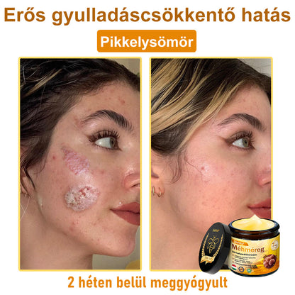 🎁 Már csak 5 doboz maradt! További 50% kedvezményt adunk! Legyél fitt és egészséges! Ha most kihagyod, jövőre már nem lesz rá lehetőséged.